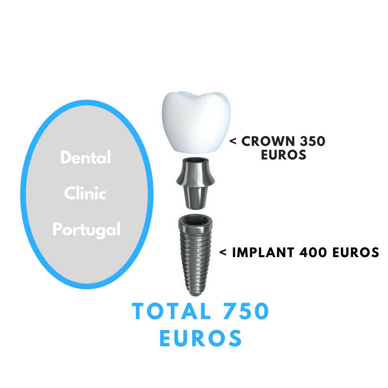 Dental Implant Portugal Implant Clinic