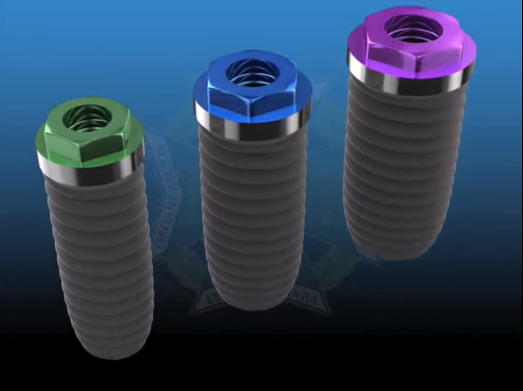 Dental titanium implants Implant Clinic