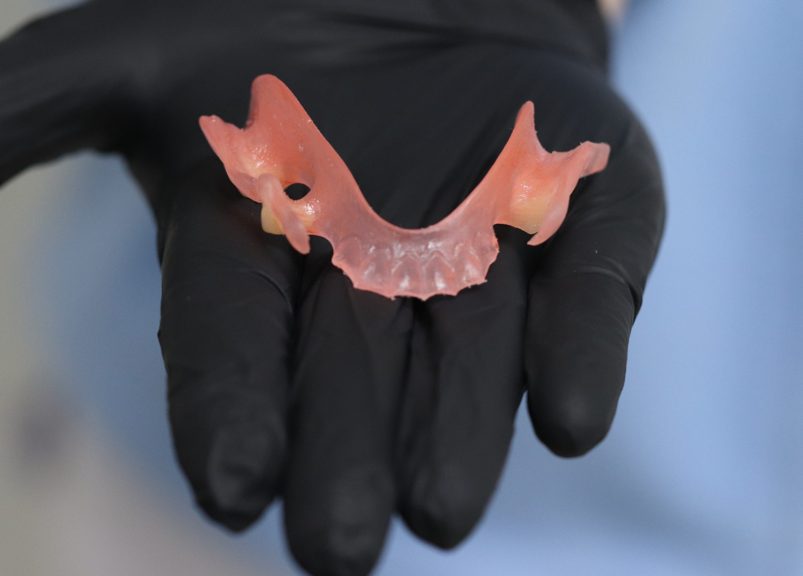 Flexible and removable dentures