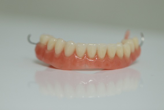 Removable partial dentures