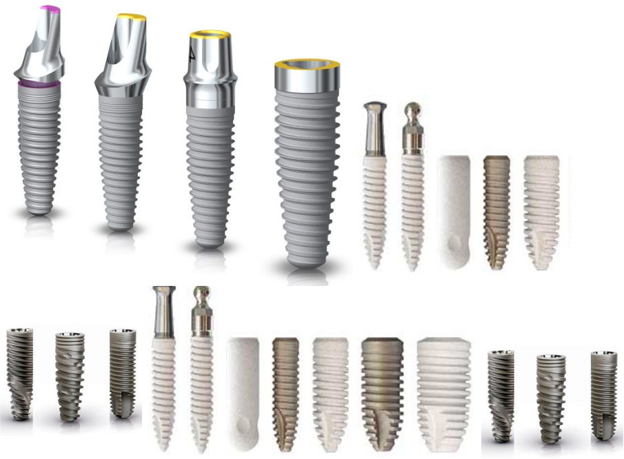 tooth implant types