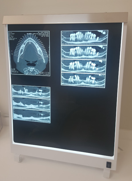 computerised axial tomography scan