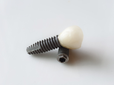 Dental implants