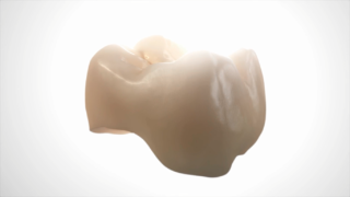 Dental crown